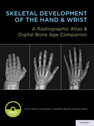 Kniha Skeletal Development of the Hand and Wrist Cree M. Gaskin