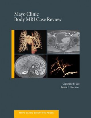 Könyv Mayo Clinic Body MRI Case Review James F. Glockner