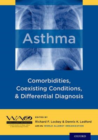 Knjiga Asthma Richard F. Lockey