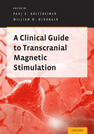 Könyv Clinical Guide to Transcranial Magnetic Stimulation Paul E. Holtzheimer