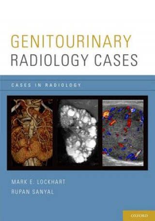 Kniha Genitourinary Radiology Cases Mark Lockhart