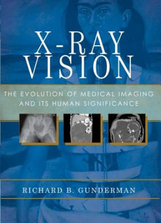 Kniha X-Ray Vision Richard B. Gunderman