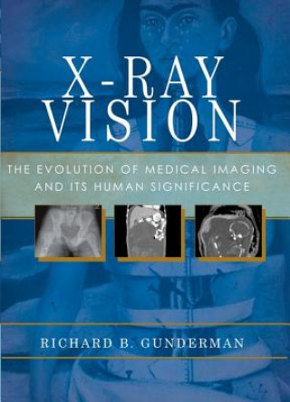 Book X-Ray Vision Richard B. Gunderman