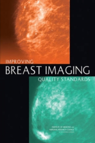 Carte Improving Breast Imaging Quality Standards Committee on Improving Mammography Quality Standards