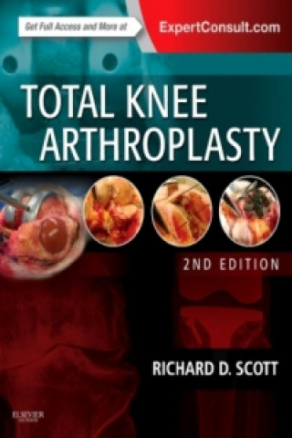 Könyv Total Knee Arthroplasty Richard D. Scott