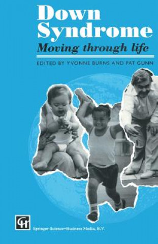 Book Down Syndrome Yvonne Burns and Pat Gunn