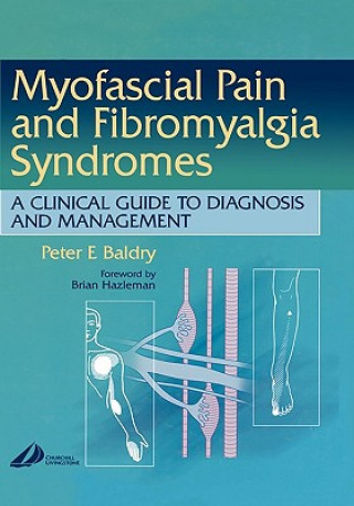 Carte Myofascial Pain and Fibromyalgia Syndromes Peter E. Baldry