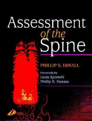 Книга Assessment of the Spine Phillip Ebrall