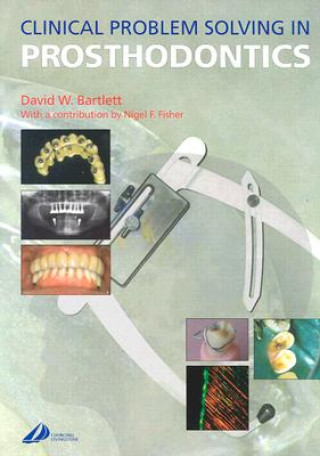 Kniha Clinical Problem Solving in Prosthodontics David W. Bartlett