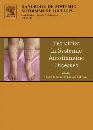 Kniha Pediatrics in Systemic Autoimmune Diseases Rolando Cimaz