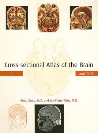 Carte Cross-sectional Atlas of the Brain and DVD Peter Ratiu