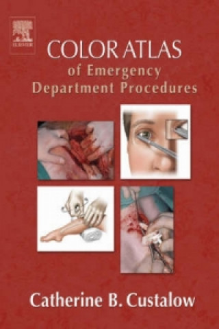 Carte Color Atlas of Emergency Department Procedures Catherine Custalow