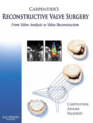 Libro Carpentier's Reconstructive Valve Surgery David H. Adams