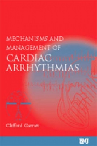 Książka Mechanisms and Management of Cardiac Arrhythmias Clifford Garratt