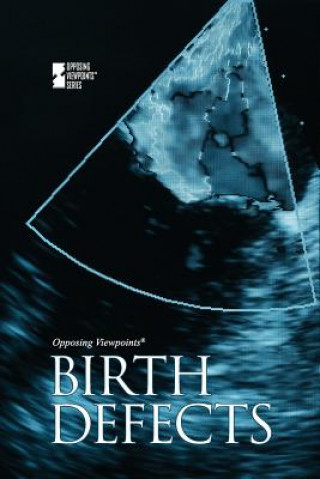 Livro Birth Defects Noel Merino