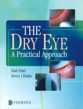Книга Dry Eye Sudi Patel