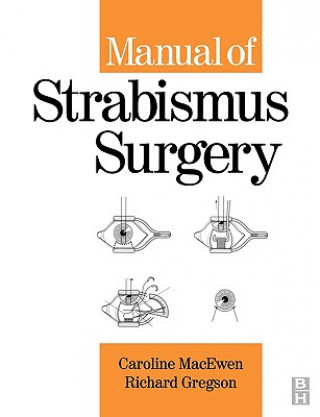 Könyv Manual of Strabismus Surgery C.J. MacEwen