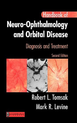 Könyv Handbook of Neuro-Ophthalmology Robert L. Tomsak