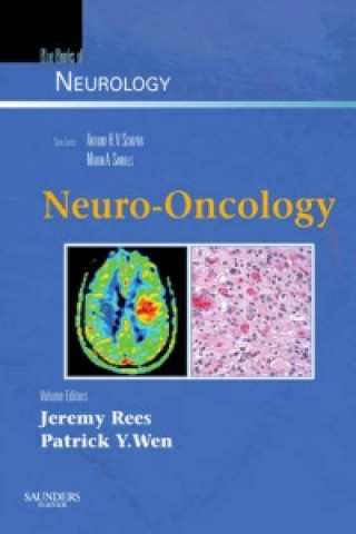 Könyv Neuro-Oncology Jeremy Rees