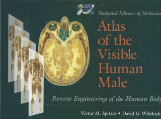 Carte National Library Of Medicine Atlas Of The Visible Human Male: Reverse Engineering Of The Human Body Victor M. Spitzer