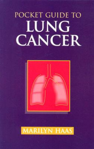 Kniha Pocket Guide To Lung Cancer Marilyn Haas