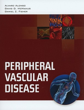 Kniha Peripheral Vascular Disease Daniel Z. Fisher