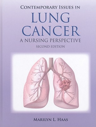 Carte Contemporary Issues In Lung Cancer Marilyn Haas