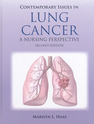 Kniha Contemporary Issues In Lung Cancer Marilyn Haas