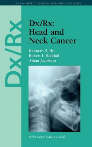 Buch Dx/Rx: Head And Neck Cancer Kenneth S. Hu