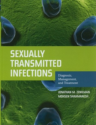 Könyv Sexually Transmitted Infections: Diagnosis, Management, And Treatment Jonathan M. Zenilman