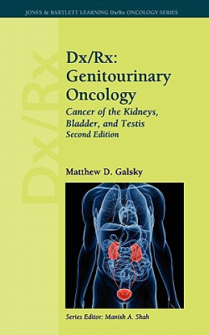Carte Dx/Rx: Genitourinary Oncology: Cancer Of The Kidneys, Bladder, And  Testis Matthew D. Galsky