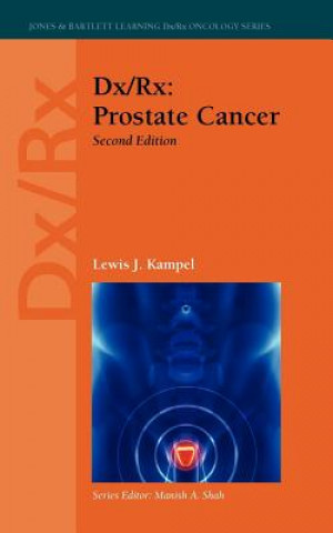 Könyv Dx/Rx: Prostate Cancer Lewis J. Kampel