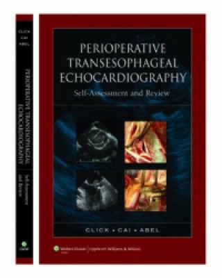 Kniha Perioperative Transesophageal Echocardiography Self-Assessment and Review Martin D. Abel