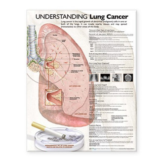 Materiale tipărite Understanding Lung Cancer Anatomical Chart 
