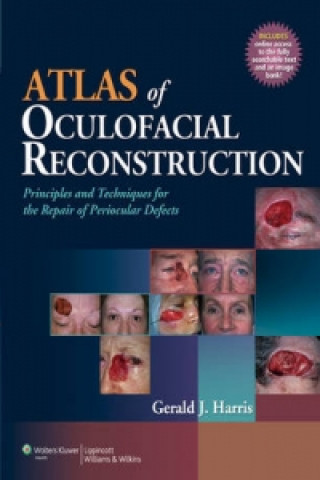 Kniha Atlas of Oculofacial Reconstruction Gerald J. Harris
