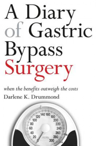 Knjiga Diary of Gastric Bypass Surgery Darlene K. Drummond