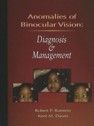 Kniha Anomalies Of Binocular Vision Robert P. Rutstein