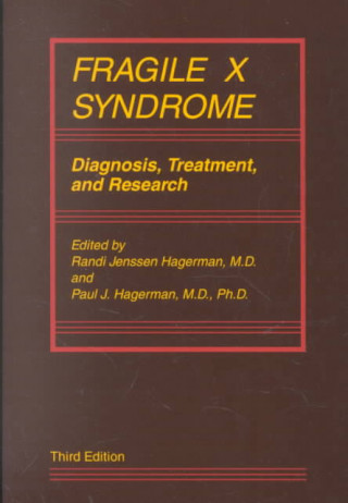 Kniha Fragile X Syndrome Paul J. Hagerman