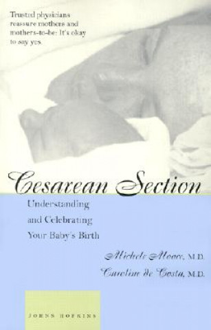 Boek Cesarean Section Michele C. Moore