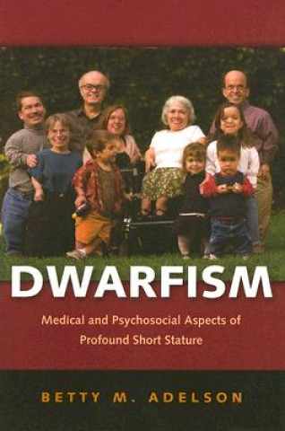 Buch Dwarfism Betty M. Adelson