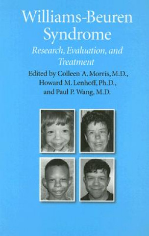 Knjiga Williams-Beuren Syndrome 