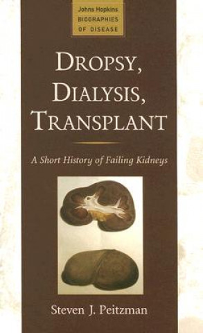 Kniha Dropsy, Dialysis, Transplant Steven J. Peitzman