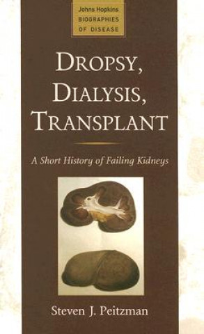 Książka Dropsy, Dialysis, Transplant Steven J. Peitzman