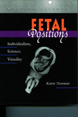 Livre Fetal Positions Karen Newman