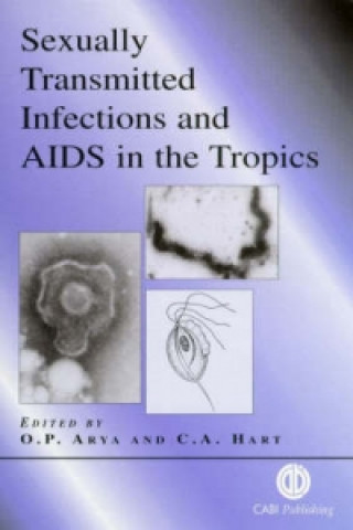 Książka Sexually Transmitted Infections and AIDS in the Tropics C.A. Hart