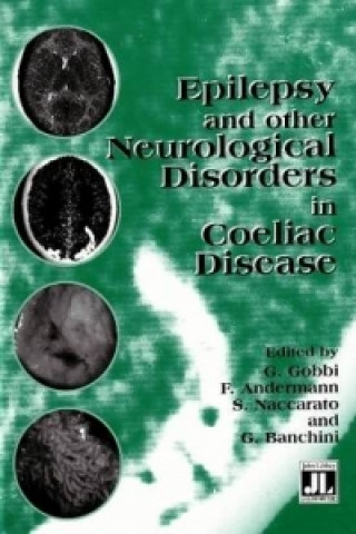 Könyv Epilepsy & Other Neurological Disorders in Coeliac Disease 