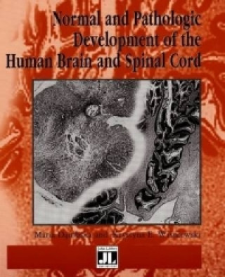 Carte Normal & Pathologic Development of the Human Brain & Spinal Cord 
