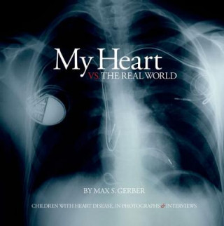 Książka My Heart Vs. the Real World Max S. Gerber
