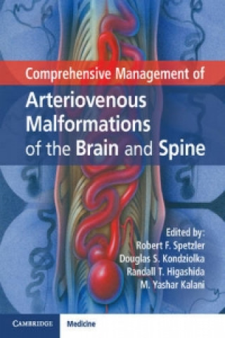 Knjiga Comprehensive Management of Arteriovenous Malformations of the Brain and Spine Robert F. Spetzler