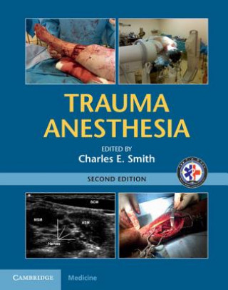 Knjiga Trauma Anesthesia Charles E. Smith